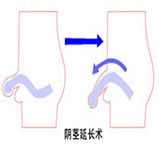 生殖整形百科4